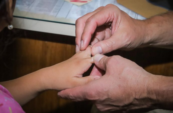 La Fundación Mercantil Santa Cruz anuncia una nueva campaña gratuita de cirugía de manos en la ciudad de La Paz.